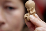 Минздрав намерен ввести лицензии на осуществление абортов